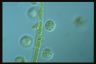 Choanocystis