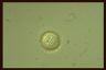 Acanthocystis turfacea