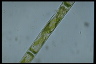 Spirogyra