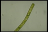 Spirogyra