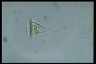 Vorticella