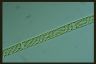 Spirogyra