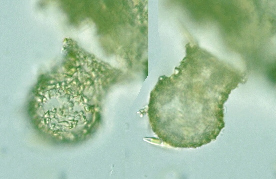 Codonella